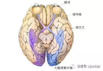 视神经萎缩: 常见病因、预防及治疗