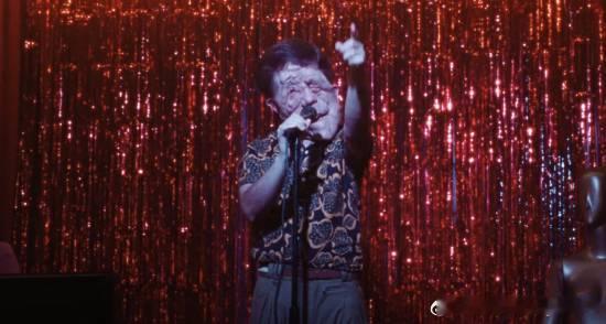 残障毁容演员亮相奥斯卡，面部布满良性肿瘤在2026年第98届奥斯卡金像奖红毯上，