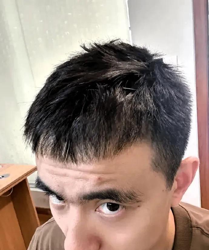 赵继伟大概率不会被选入国家队，嗓子治疗已进入针灸阶段！他太不容易了吧，十年国家