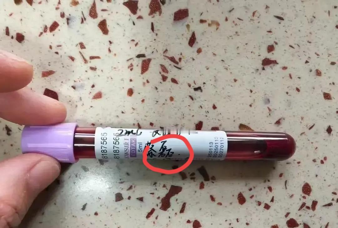 蔡磊把自己彻底“解剖”了。国内第一份渐冻症“完美”基因组，T2T级测序。这哪