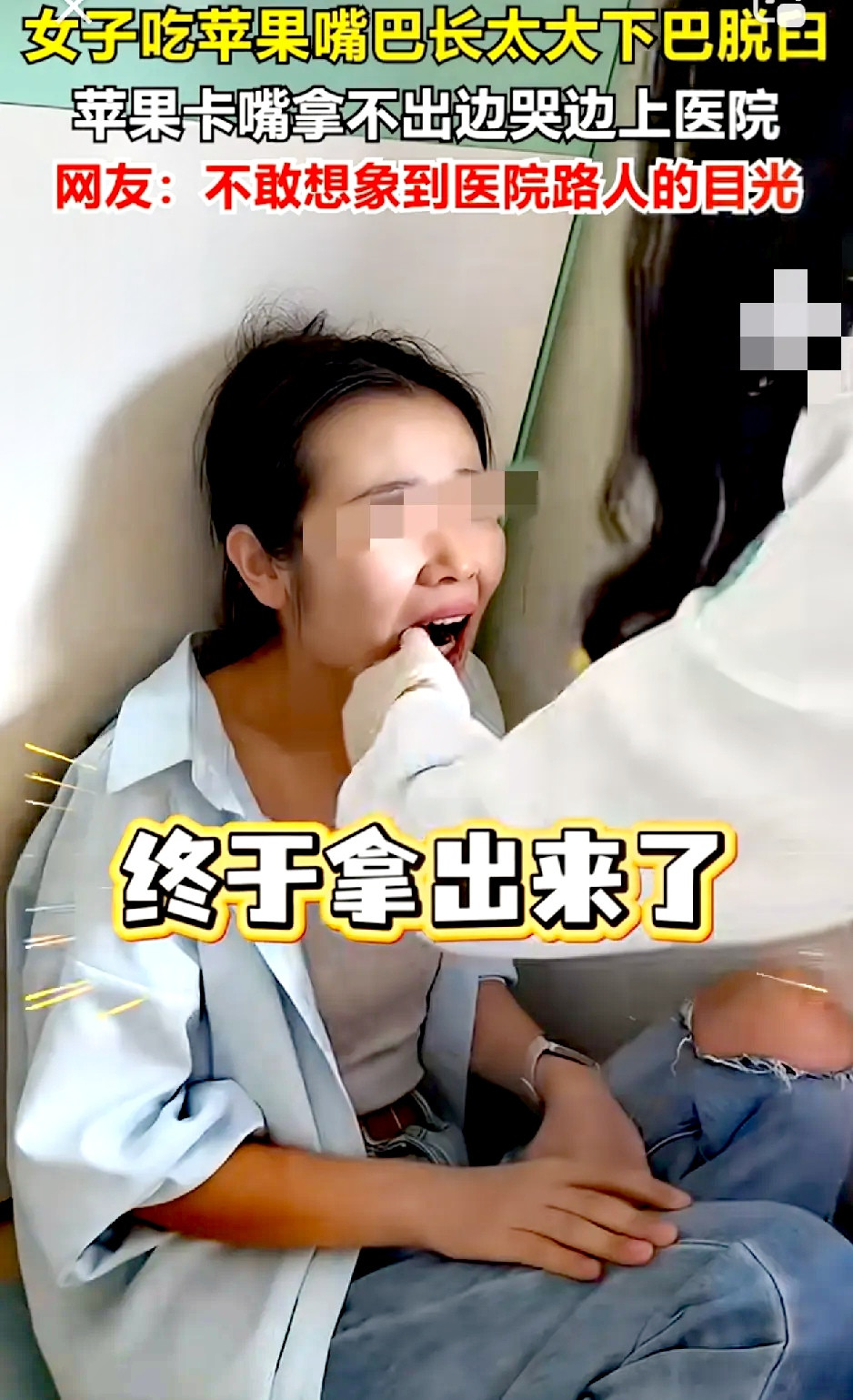 “笑死我了”。浙江一名女子吃苹果，吃到最后一口时，刚一口咬下去，突然感觉嘴合不上了，苹果还卡在嘴里。