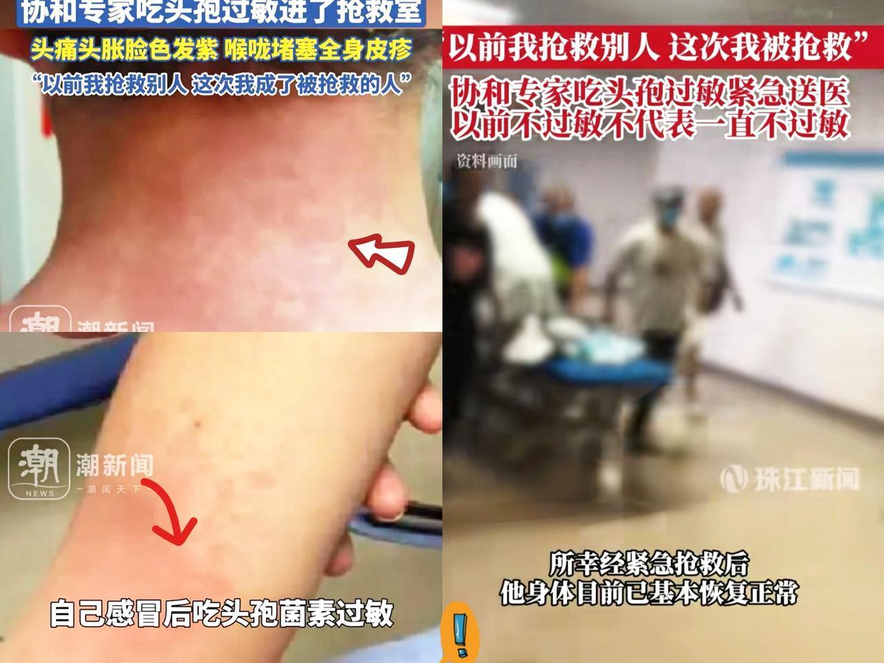 万万没想到，协和的谭先杰教授，天天在手术台救别人的人，因为一片头孢自己竟然进