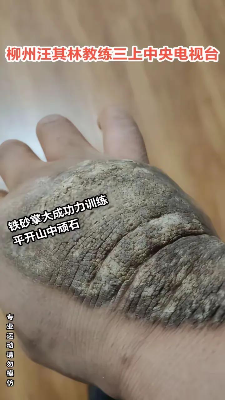 你敢相信，这是一只人的手？他不是得了什么病，而是长期练功自然形成的。据说，这只