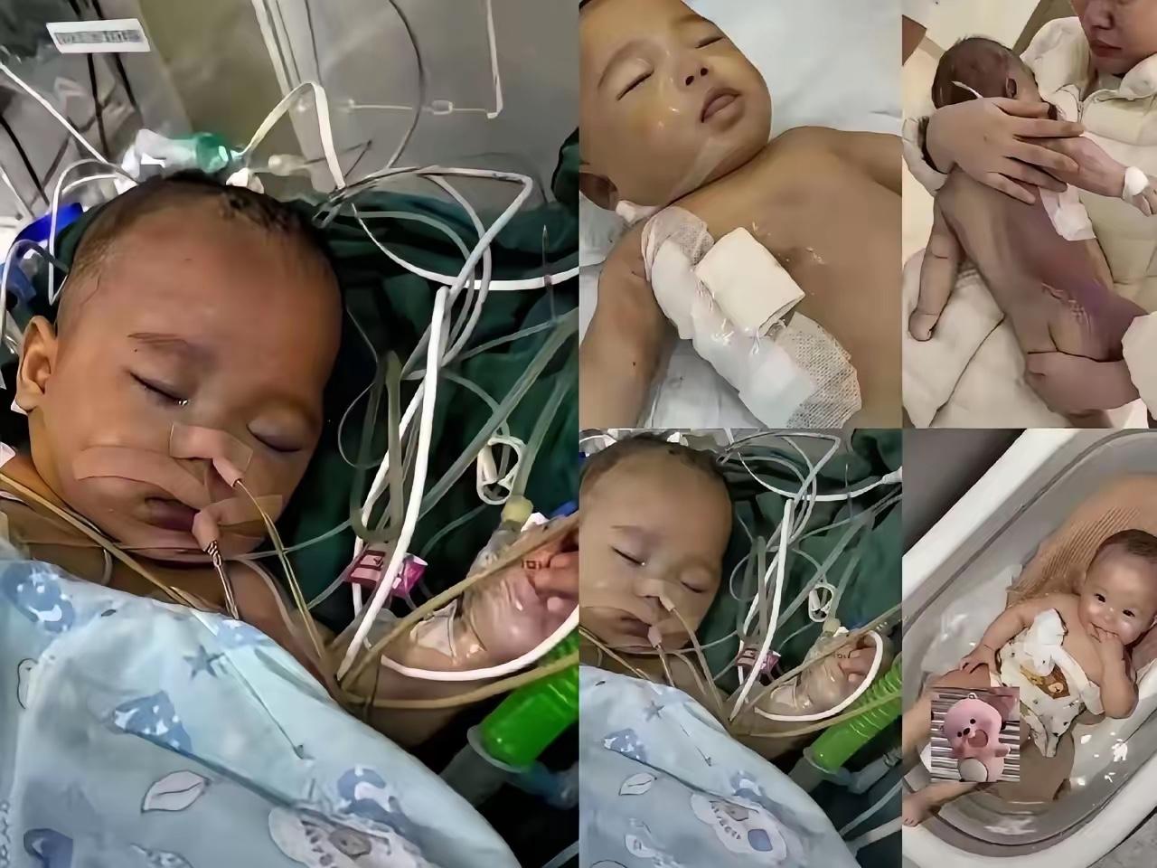 央视终于出手！浙江五个月宝宝微创手术离世，令人揪心。本是医生口中2小时搞定的