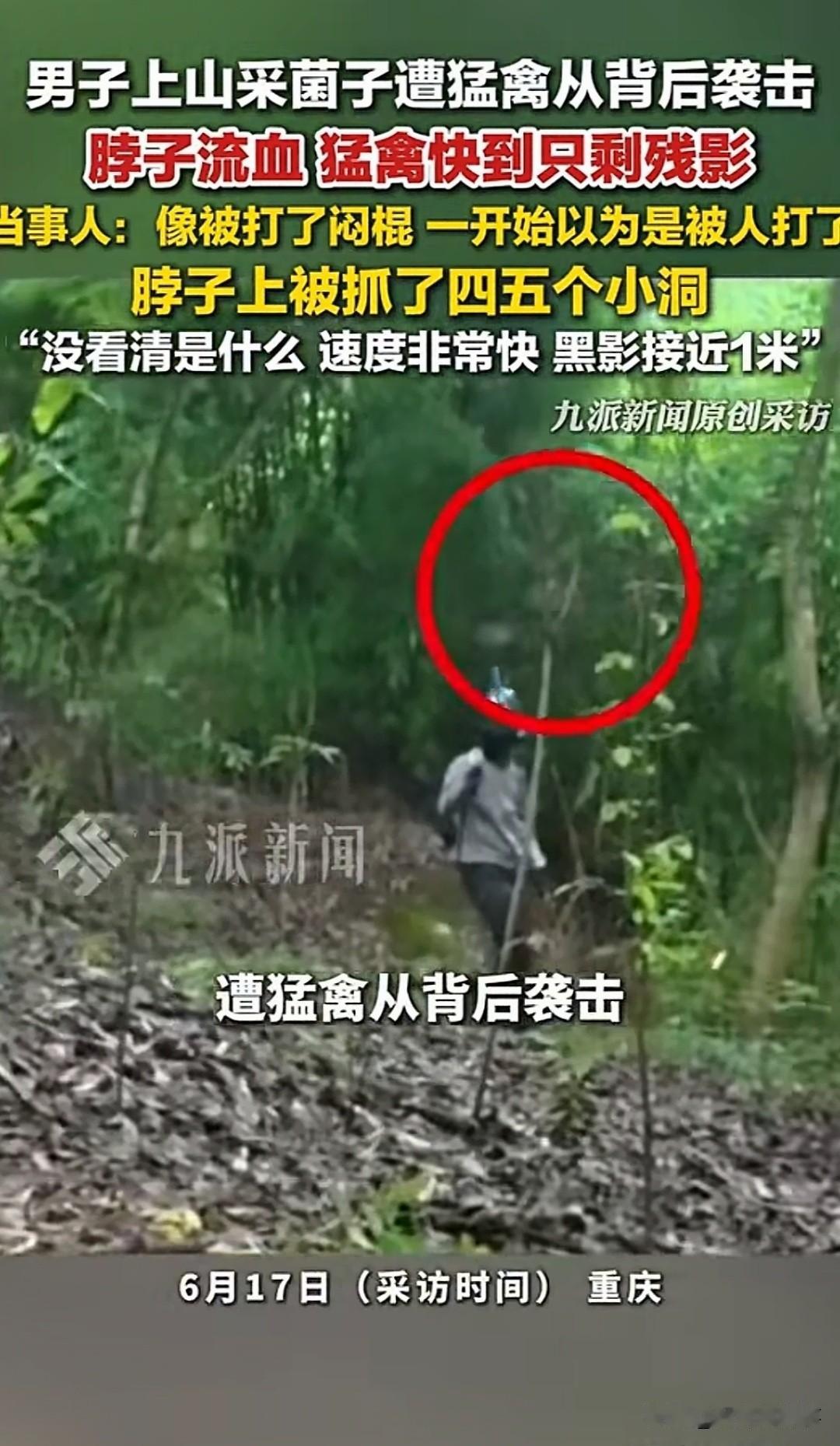 重庆璧山一男子进山捡菌子，突然天上一道黑影扑下来，对着他后颈猛抓，脖子上被掏出四