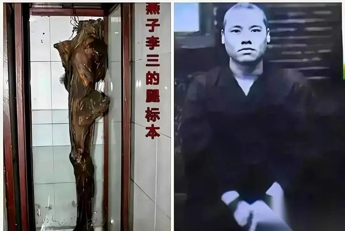 武侠都是编的？直到看见这条腿博物馆里的标本让全网吵翻了济南警察博物馆的玻