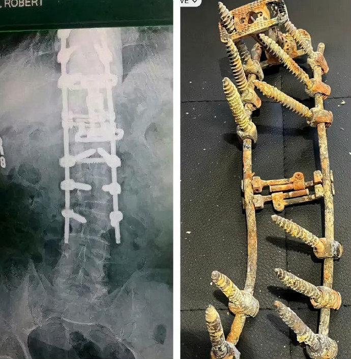 这就是普通人生活的真相：用命换钱，再花钱保命。💸今天在朋友圈看到这张图，心里