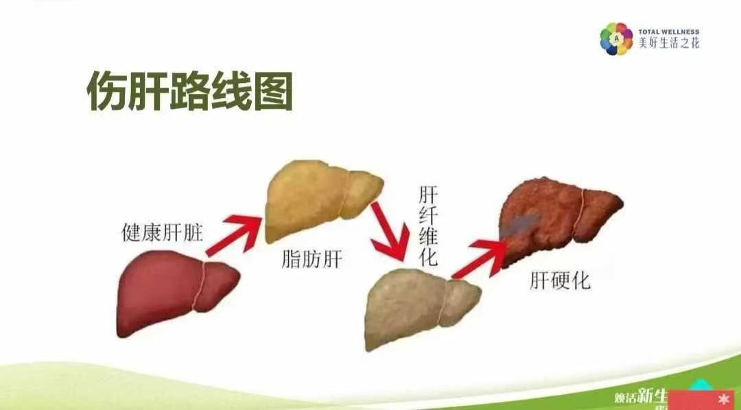 医生回应男子每年体检确诊肝癌晚期每年体检仍查出肝癌晚期，令人唏嘘。根源在于大众对