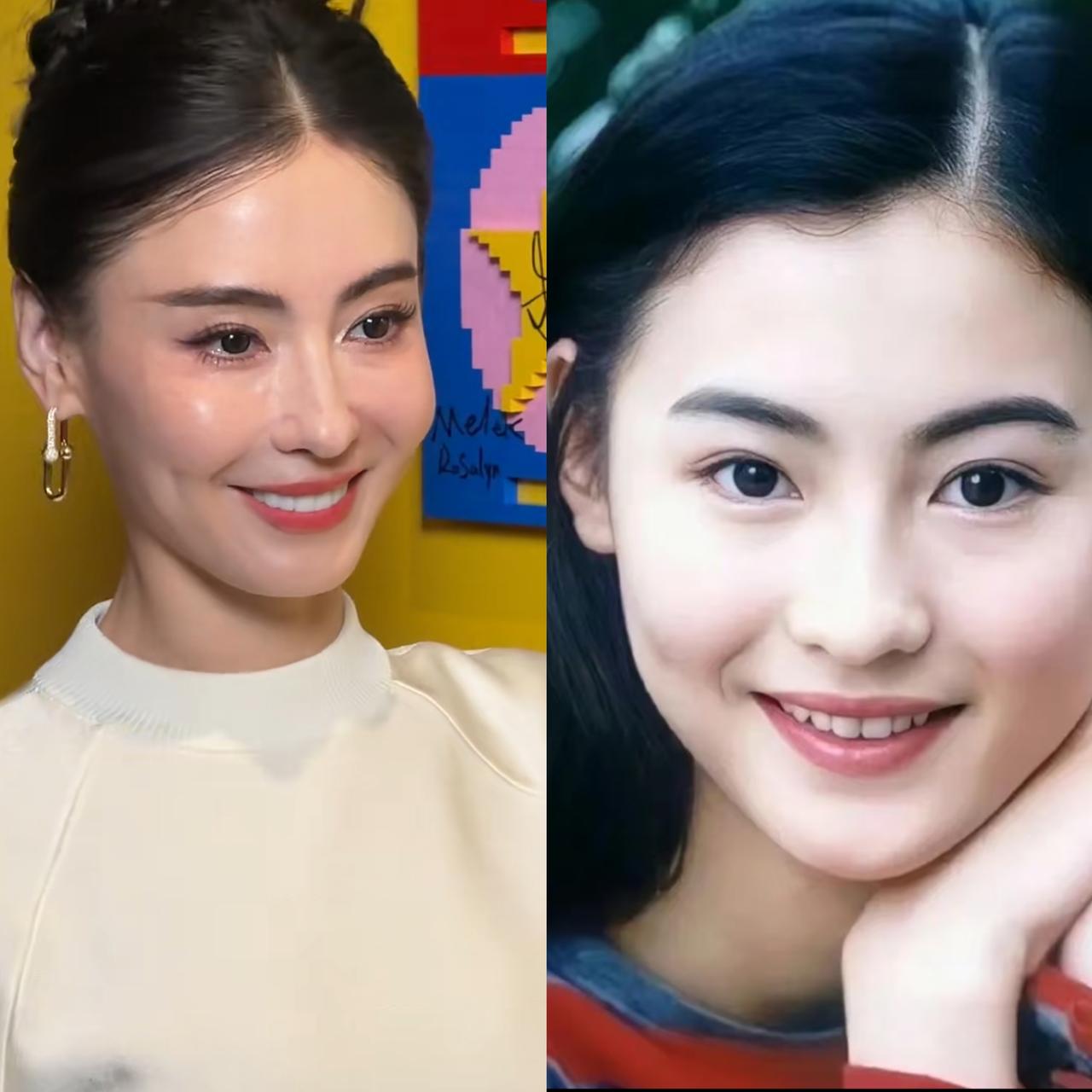 现在的张柏芝给所有爱美的女人提了个醒。你可以去拉皮，也可以去除皱，还可以打苹