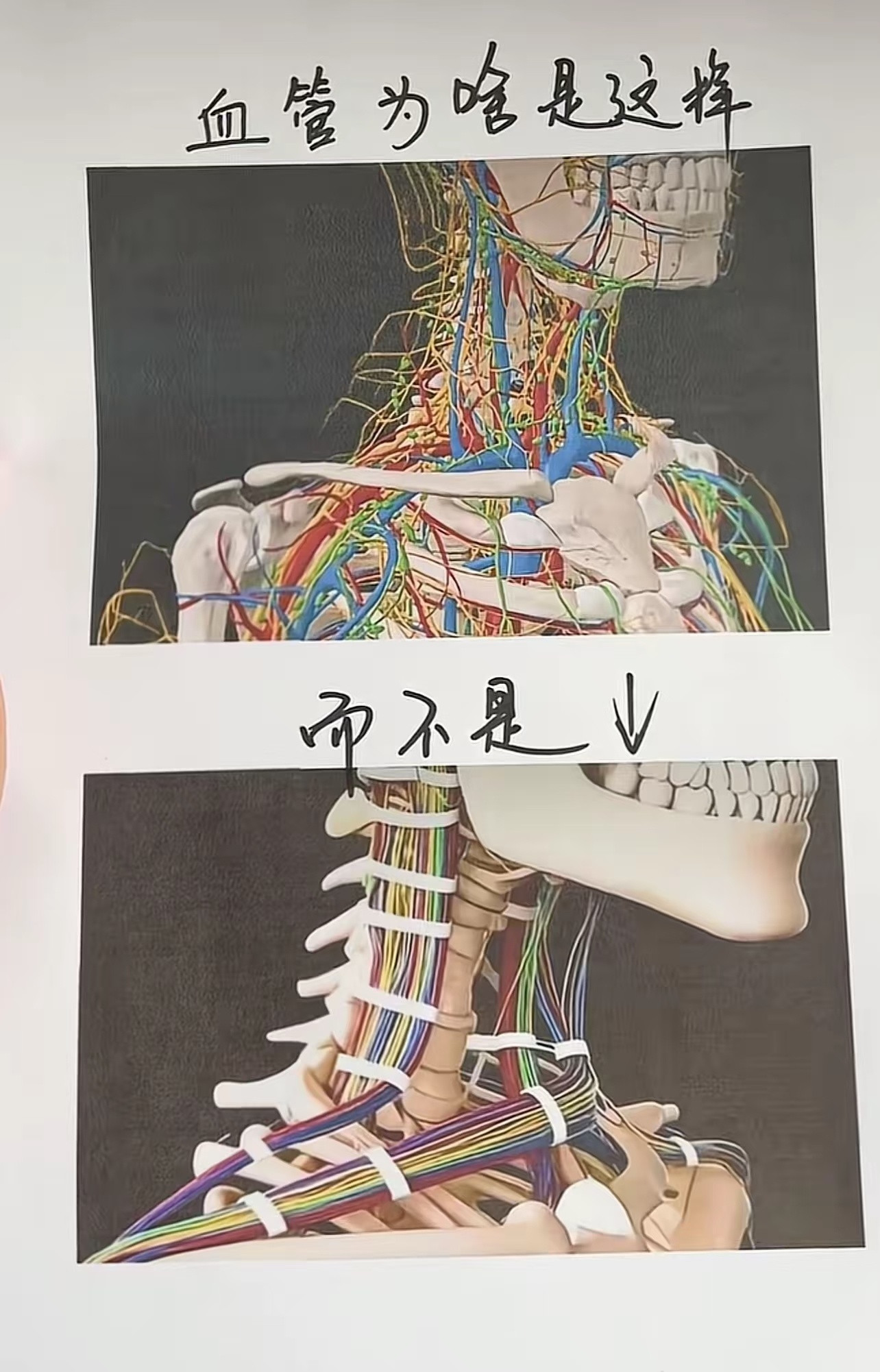 首先这是我的血管,不是电线,其次工科还是不要再去学医科要双学位了因为女娲不是个好