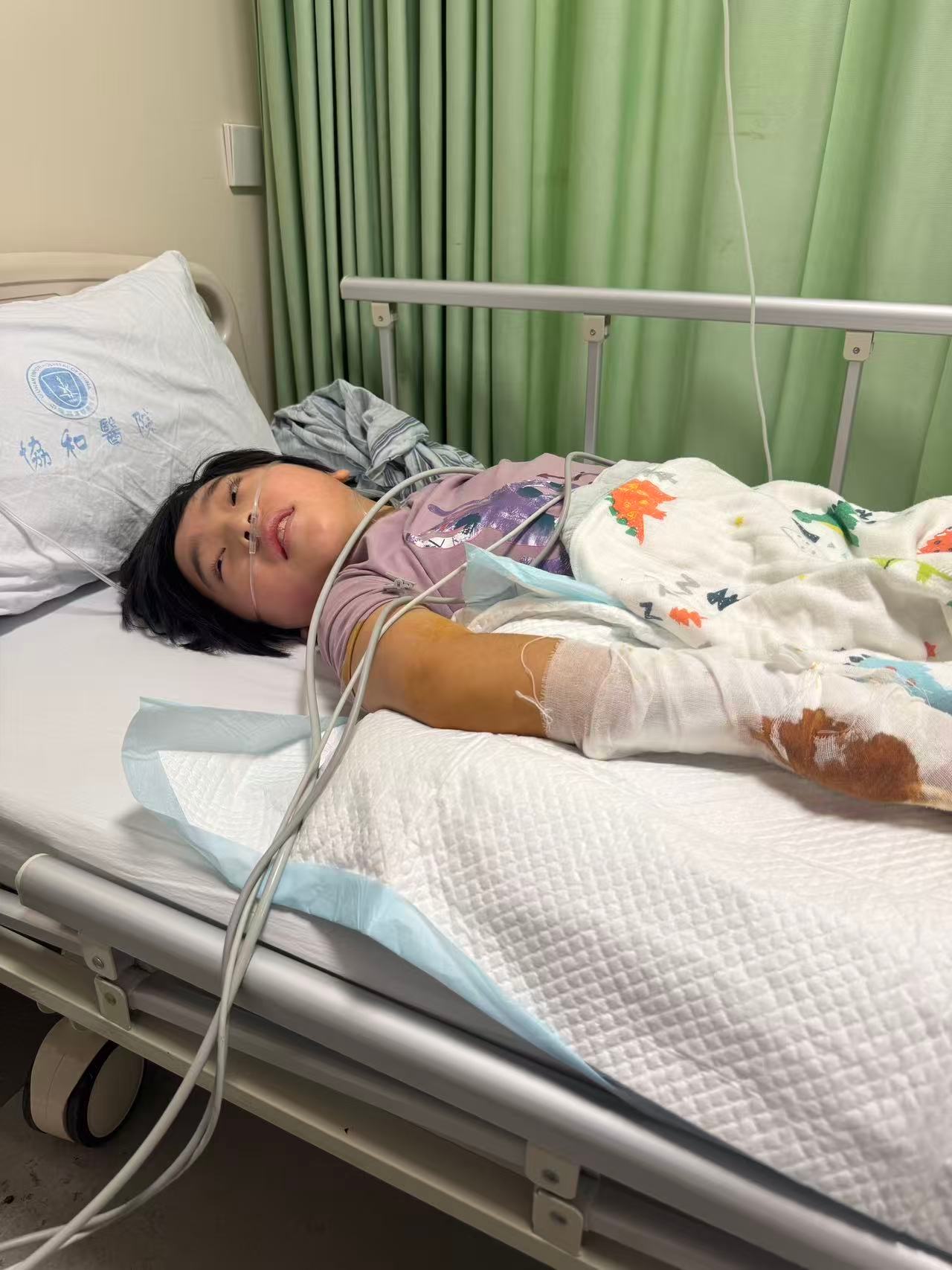 可怜的卷毛哥，这一掌下去，手里多了两颗钉子。​​​