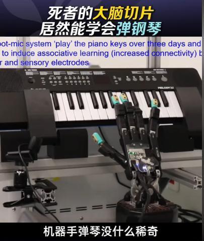 后背发凉！8月30日报道，法国科学家把刚离世遗体捐献者的大脑皮层切片放进培养皿，