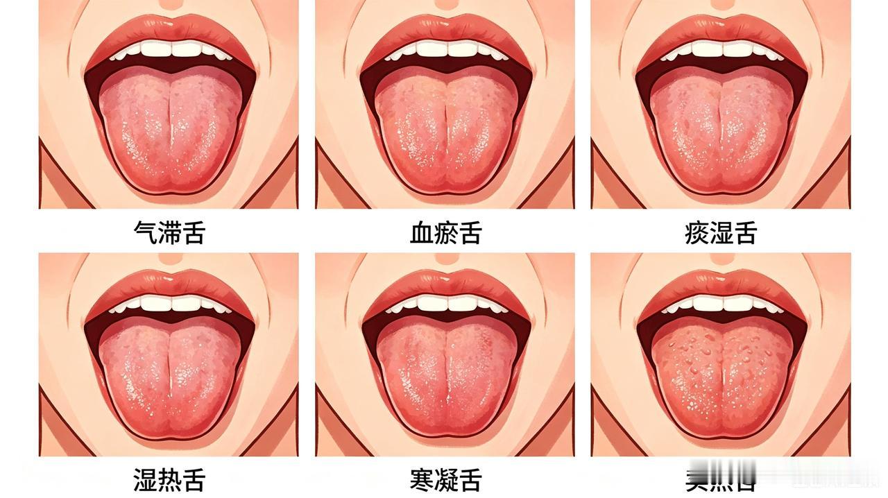 醒脑益智方一、完整配方远志10g、丹参15g、川芎8g、山楂10g、陈