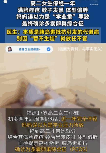 家长心真大！福建，一17岁高二女生，初潮两年后月经便持续紊乱，近一年更是完全停经