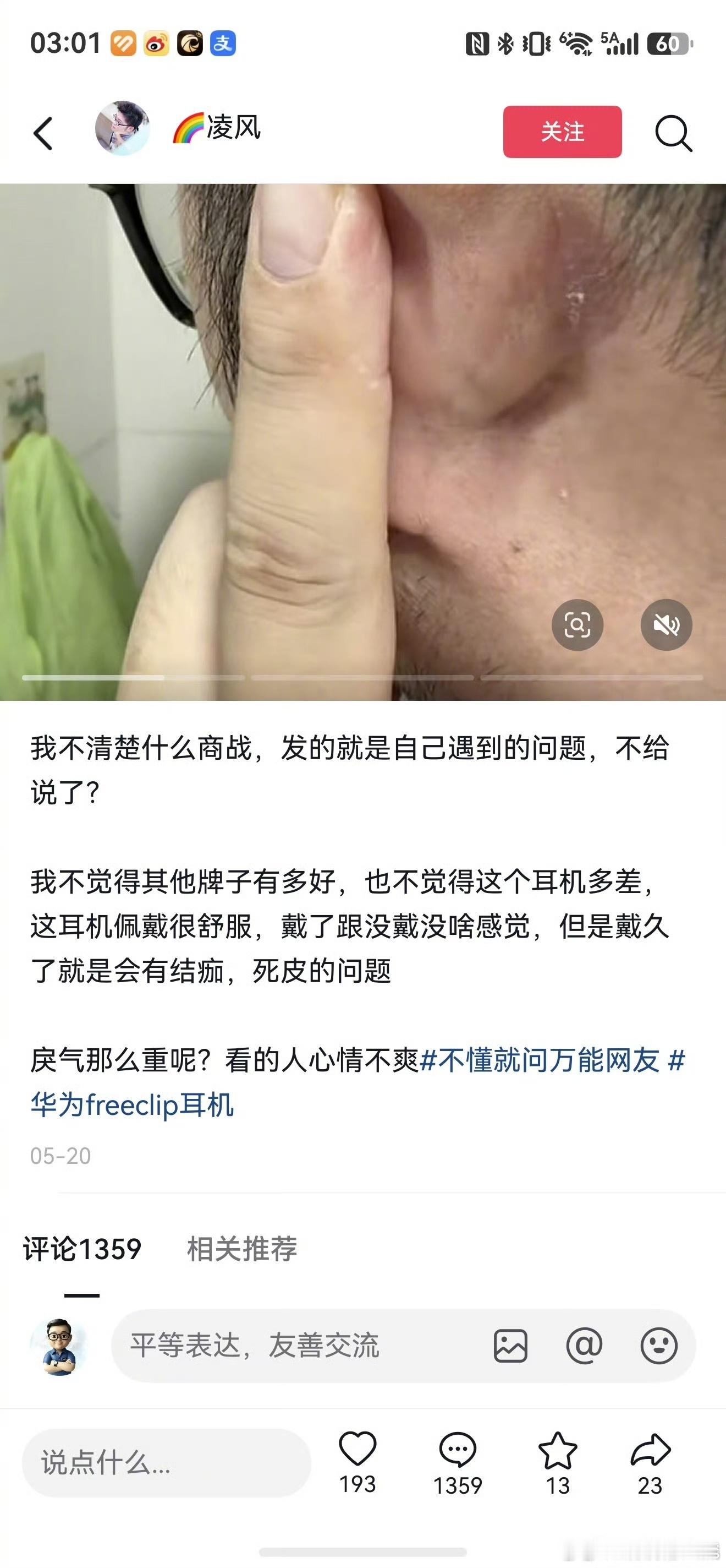 耳机弄脏的，结果遇到个懂行的……
