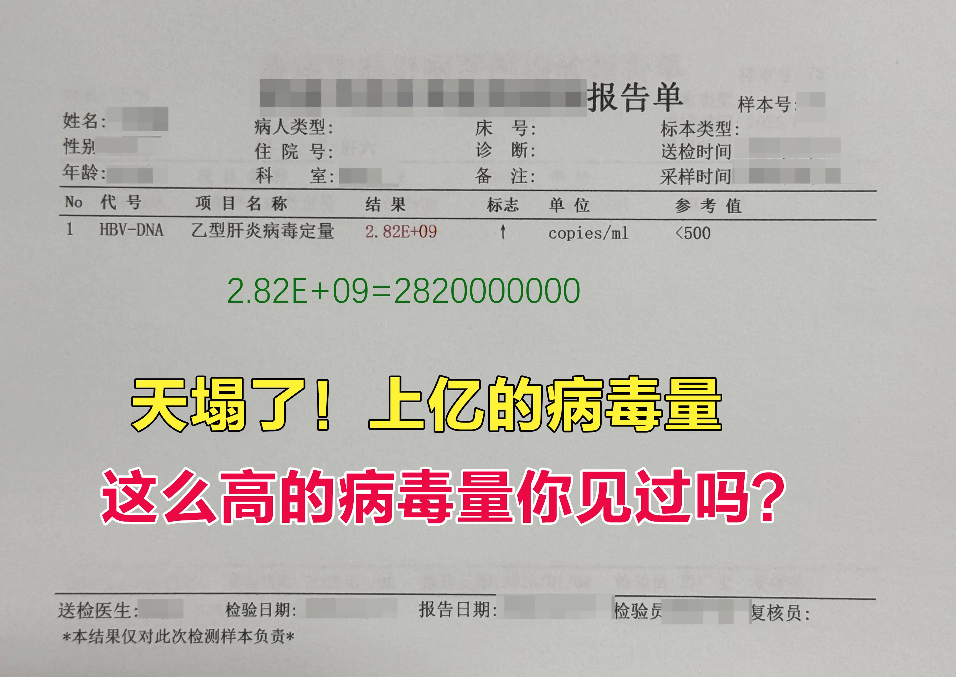 这位小伙子，你这属于高等病毒载量，病毒复制确实比较活跃，结合你的肝功能...