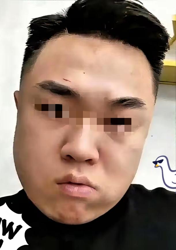 天狂必有雨，人狂必有祸，​女孩母亲态度坚决：​不签谅解书、不和解、不接受赔偿