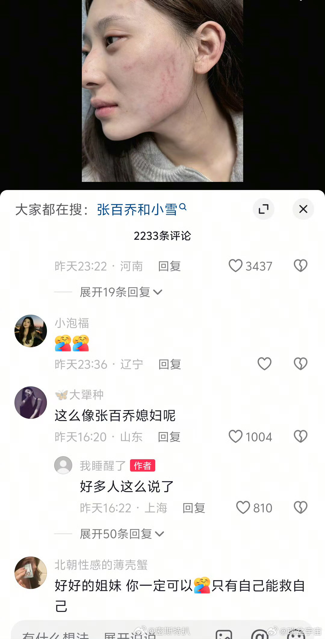 是有点像小雪，但是小雪是原生双眼皮有点内双的，那个美女是做的欧式大双，不一样，但