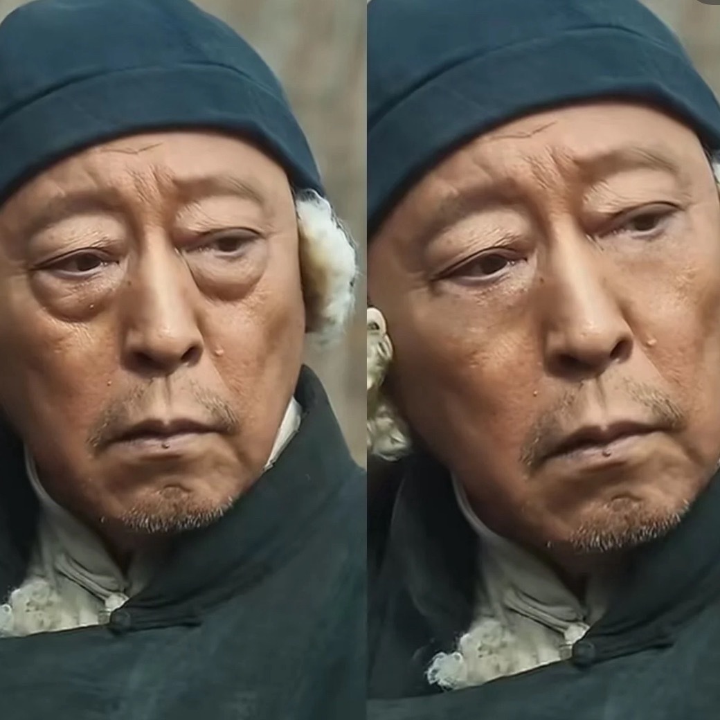 当他没有了眼袋。。。感觉反而少点啥，没有之前有特点了哈哈​​​