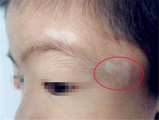 隐藏在孩子身上的这6种症状, 表明孩子肠道不健康了!