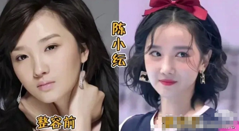 哪个女明星整容前后差距最大？