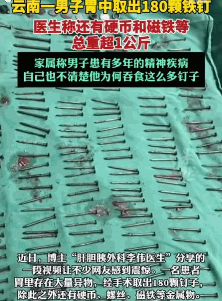 解释不清了！云南，一男子腹部剧痛送医，医生检查后当场被吓退三分：他体内居然塞满了