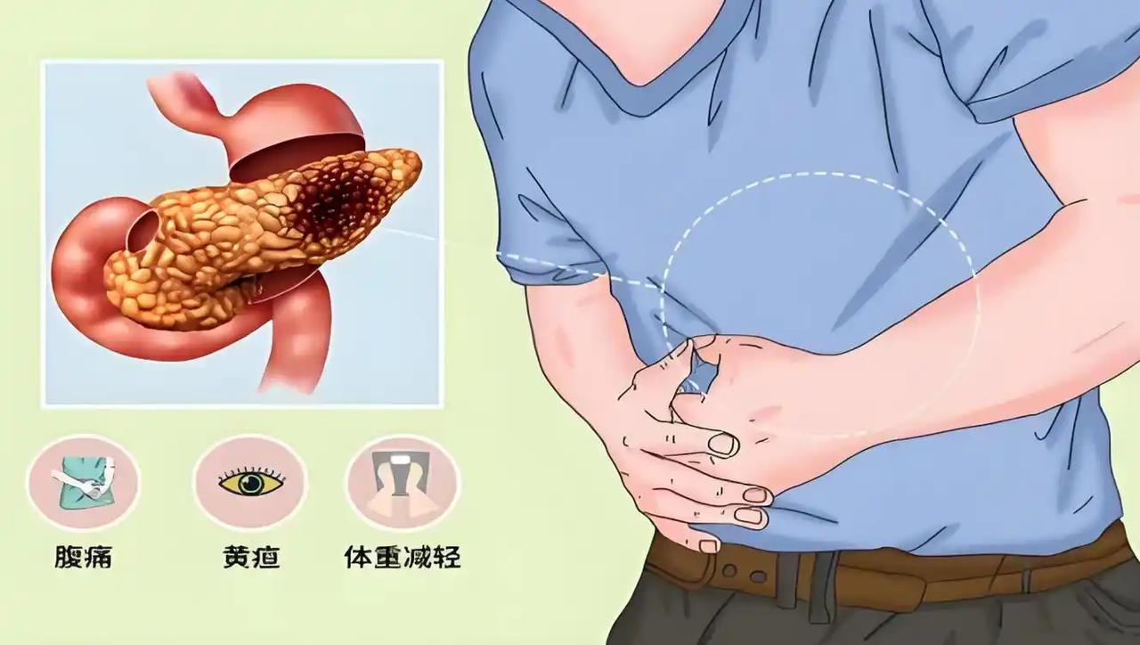 每年数万人因胰腺炎去世！医生多次全解：天气渐冷宁可喝凉水，也别吃这5物寒冬