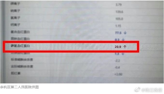 #家庭聚餐后姐弟俩双双中毒#【家庭聚餐后，浙江姐弟俩双双中毒！竟和一锅煮着的红豆