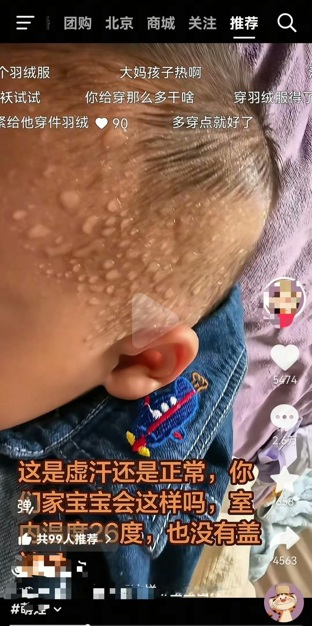 在抖音刷到的，第一眼吓我一跳，寻思这孩子是得了啥病呢。第二眼，看到给孩子穿着