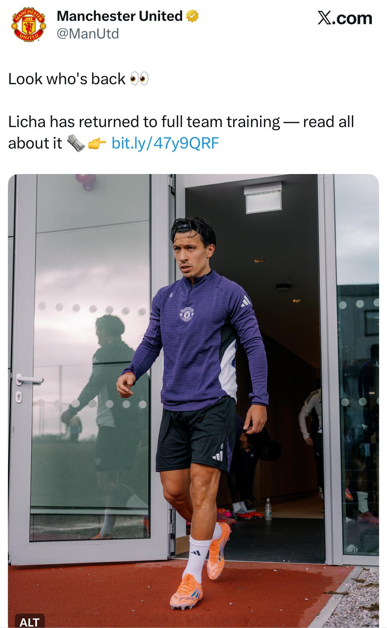 曼联官推更新：看看谁回来了利马膝盖上都是手术缝合的伤口，伤口怎么这么大啊，触目