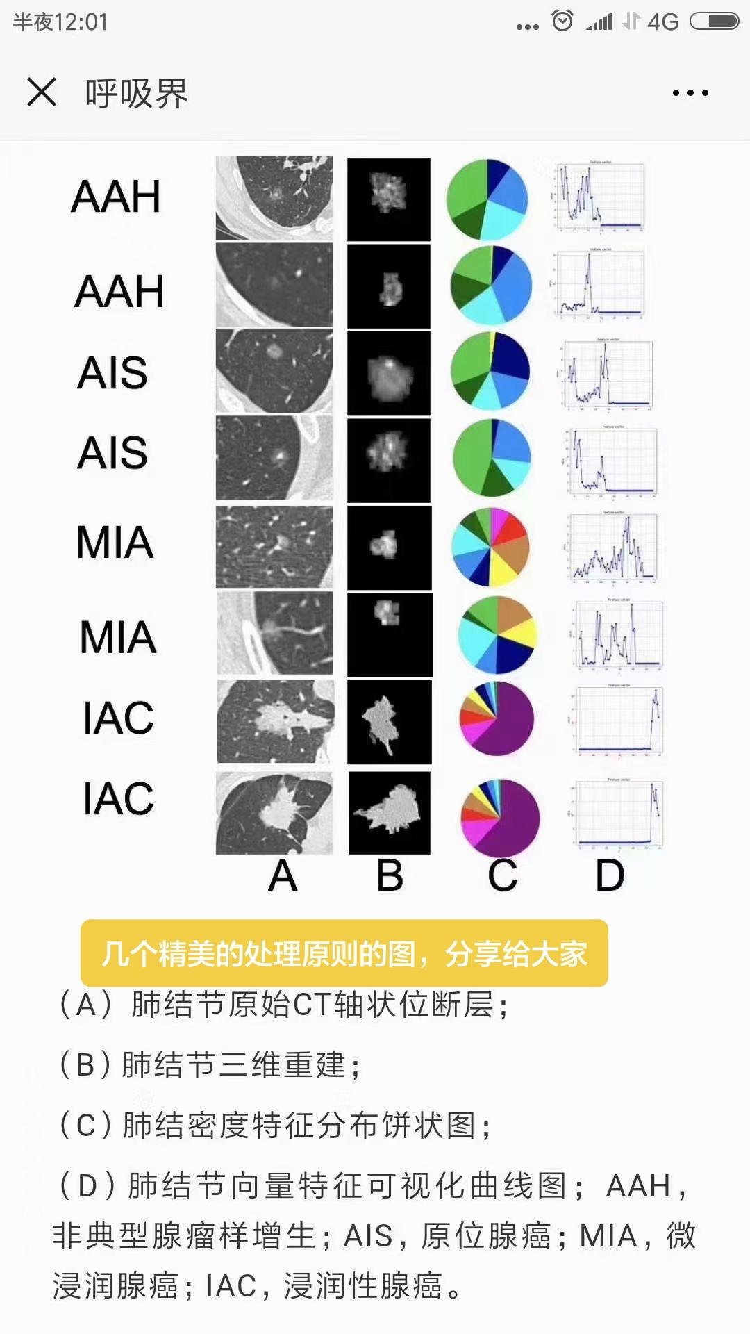 肺高危结节几个精美的处理原则的图，分享给大家……