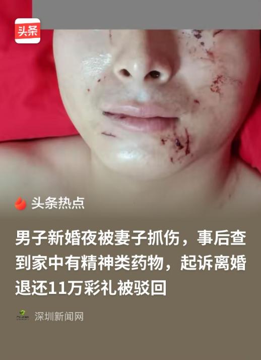 1月28日报道，四川达州，洞房花烛夜，男子想与新婚妻子发生关系，结果被抓花脸。男