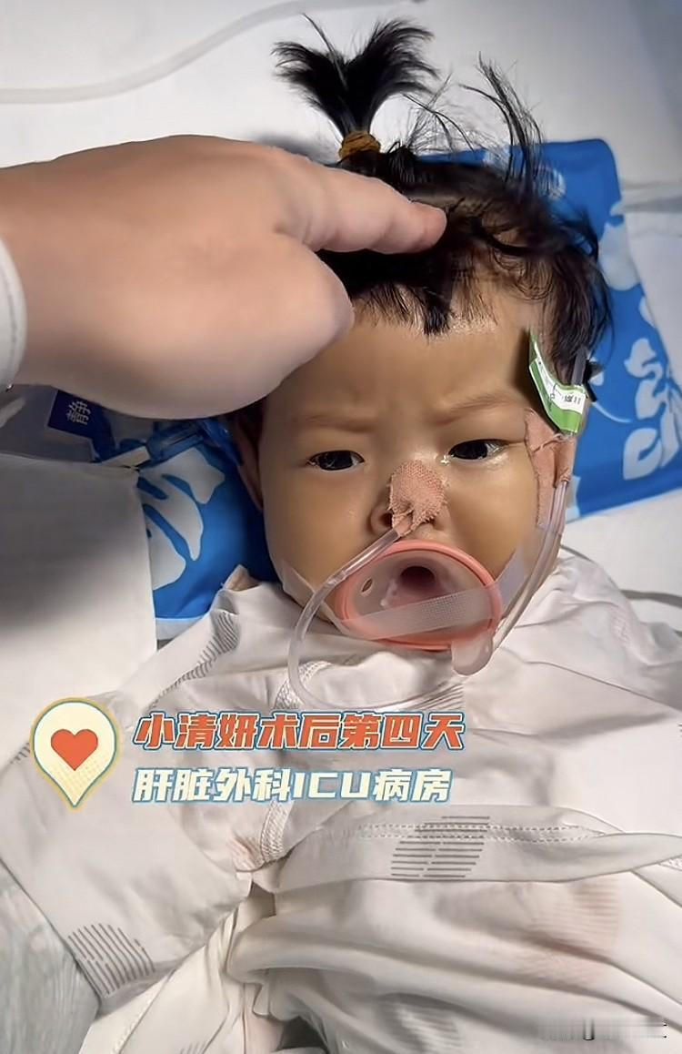 “一个妈妈的无助！”6个月大的女婴胆道闭锁，原定爸爸捐肝救女。没曾想爷爷竟然大闹
