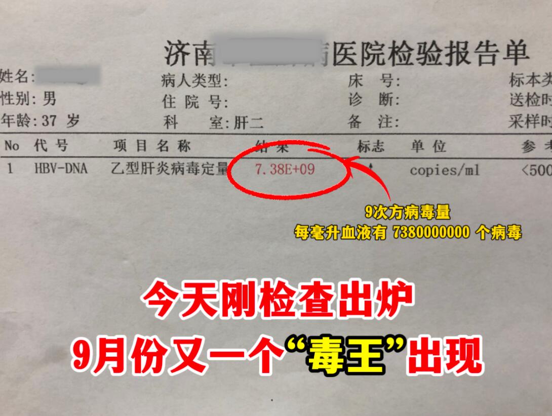 今天门诊接诊一位患者，自己平时没啥不舒服，体检一查，病毒量达到9次方...