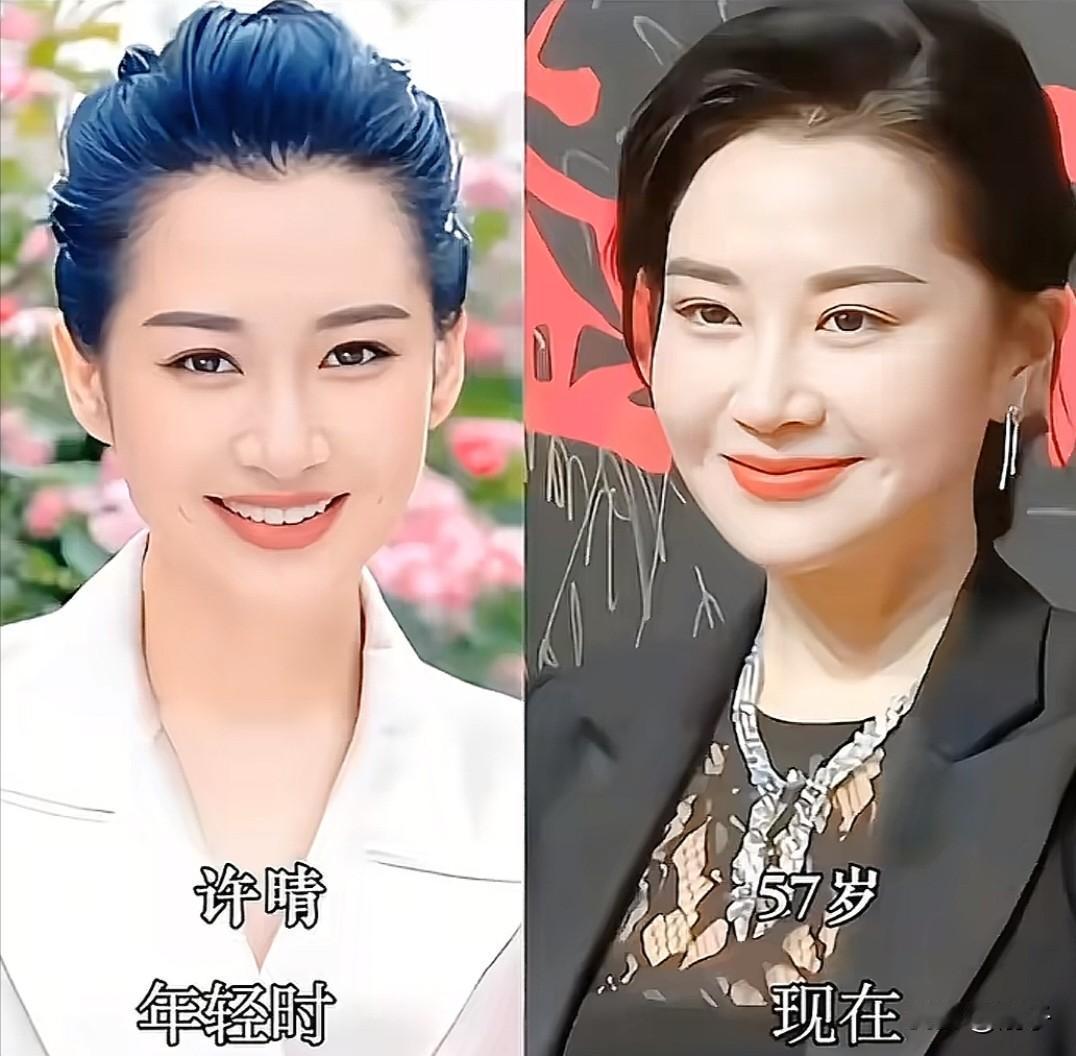 90年代的荧幕上，许晴是多少人心中的白月光。年轻时的她，穿着白西装，笑起来眼睛