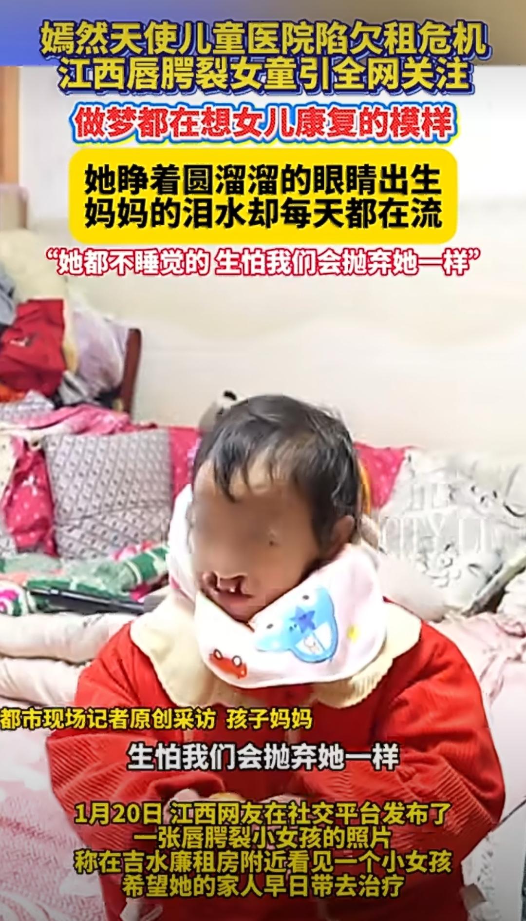 最近江西一个唇腭裂小女孩的事儿，在网上引起了好多人的关注，看着真让人又心疼又暖心