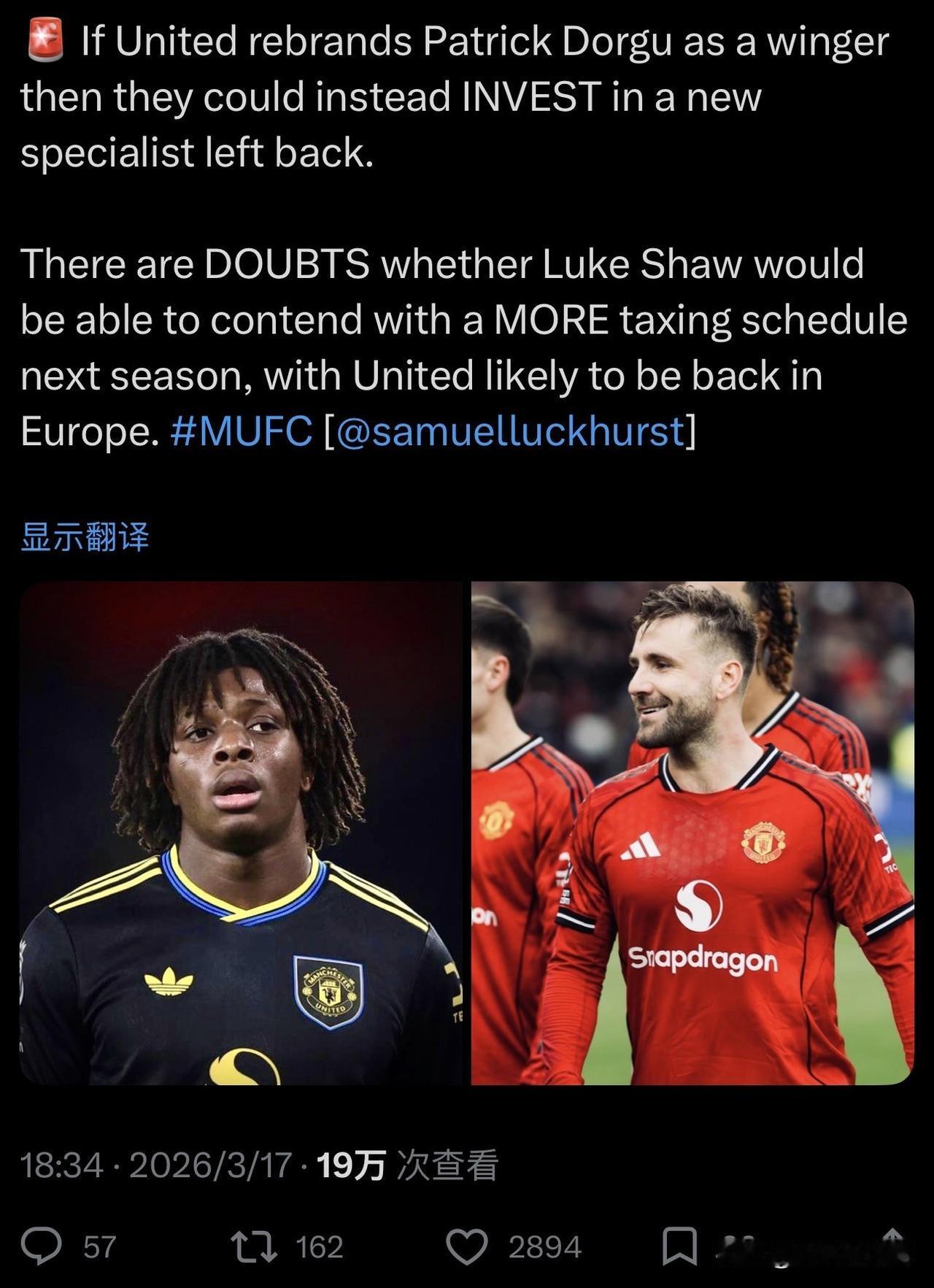 无论多尔古踢什么位置，曼联都该买一个左边锋。库尼亚踢左边，还是边前腰踢法。曼