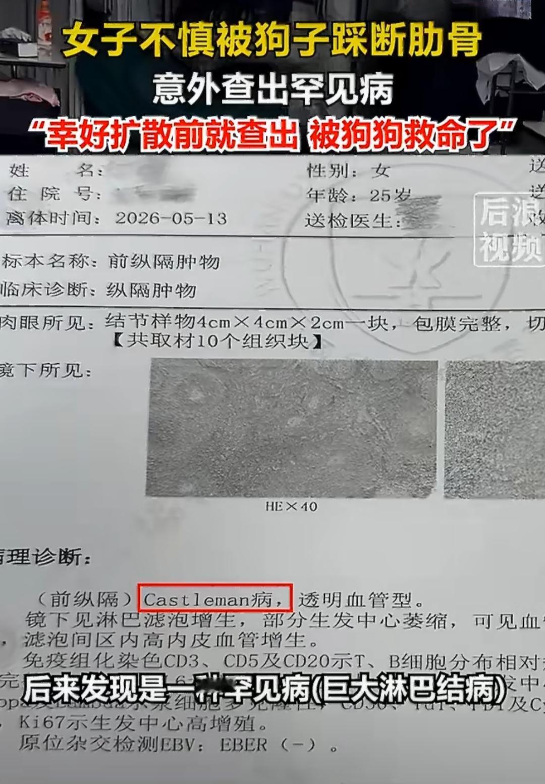 北京的王女士家里养了一只八十多斤的德牧，平时狗狗活泼又黏人，总爱凑到主人身边撒娇