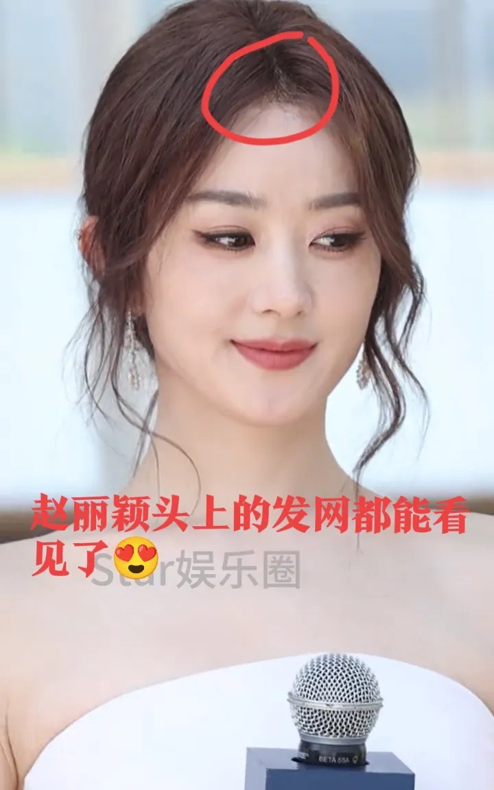 赵丽颖是不是脸动了？感觉哪里不对了我还发现她戴了假发额头上看到发网了这假