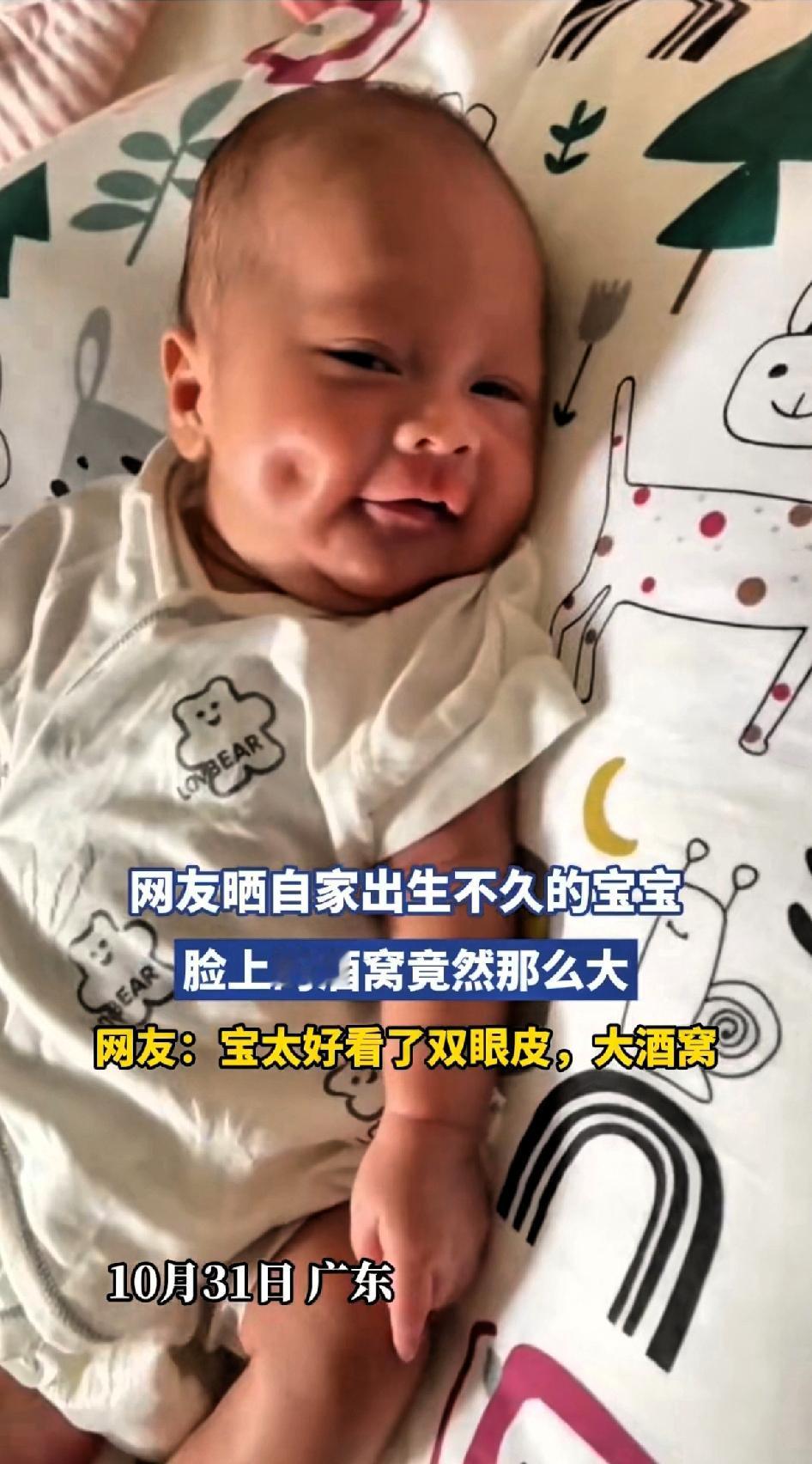 网友晒出生不久的宝宝，脸上酒窝那么大！第一次见刚出生不久就有这么明显的酒窝，只是