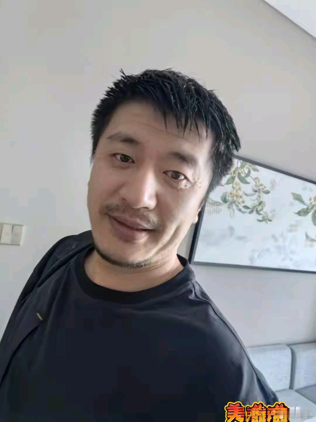 张雪峰这两张照片看着身体就不是很好了！从眼神里，看出，他好累啊