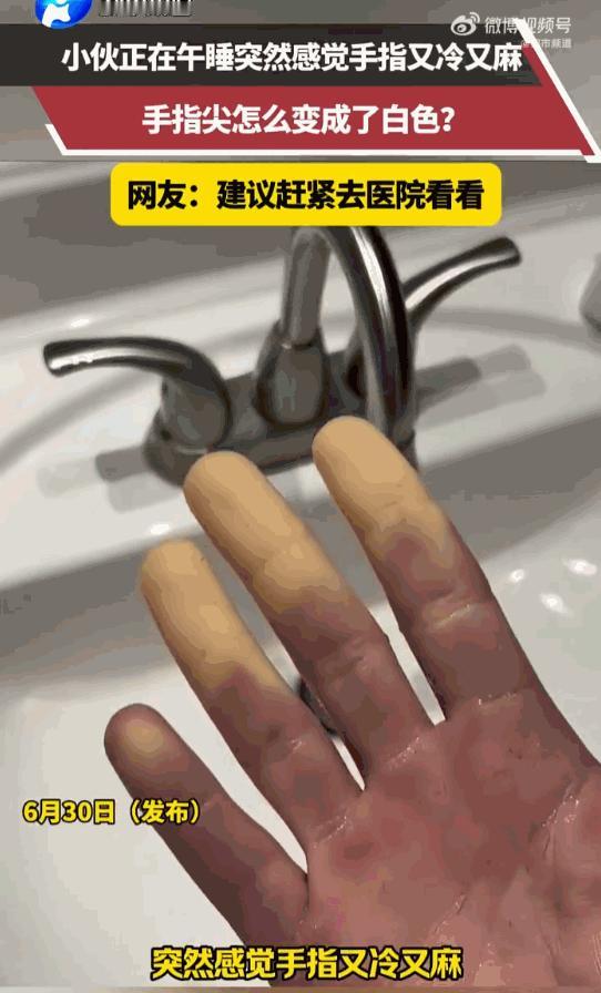 简直吓死人了！江苏一男子在23度空调房里睡午觉，正睡梦酣时突然手指传来一