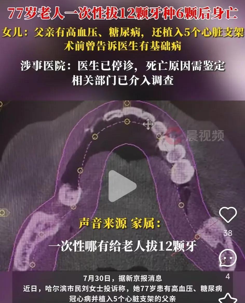 无语，即便没有基础病也没听说哪家牙医会一次性给老人拔12颗牙啊！医生在拔牙前知