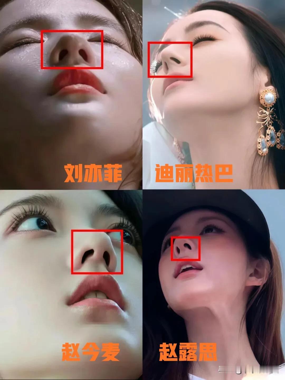 娱乐圈女星仰拍鼻型大赏，一“鼻”了然！所谓精致美鼻，仰拍视角下原形毕露，鼻孔形态