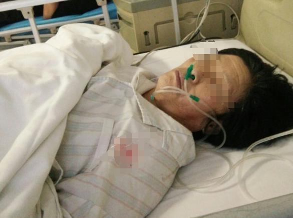拆迁款全给儿子惹祸端！78岁脑梗老太成家庭大战导火索，兄妹反目妹夫动手惊动警方