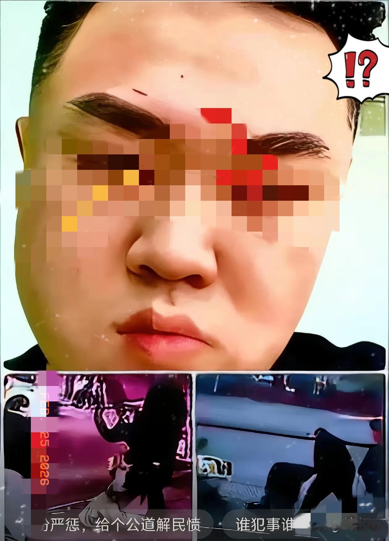 听说打人那两家现在是彻底慌了神到处托人找关系恨不得把家底都掏出来想私了。