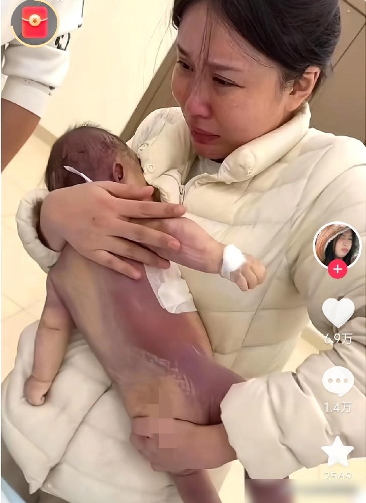 宁波妇女儿童医院陈某君！5个月宝宝洛熙，因卵圆孔未闭被推进手术室，9个小时后浑身