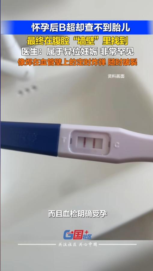 “太惊险了！”5月7日报道，广东深圳，一女子用验孕棒发现自己怀了，她赶紧去了医院