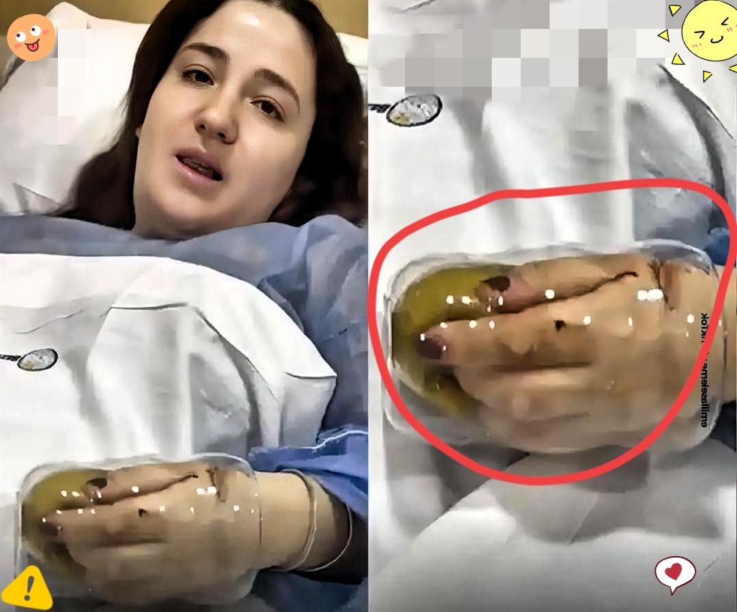 “救命！我的手被杯子‘吃’了！”你能想象吗？阿根廷一女子洗碗时，手和抹布