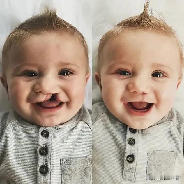 民间有“孕妇吃兔肉，孩子会得兔唇”之说。我们这边也不例外，吓得我们平时也不敢吃兔